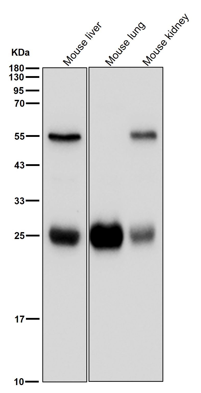 Indolamine N methyltransferase Ab