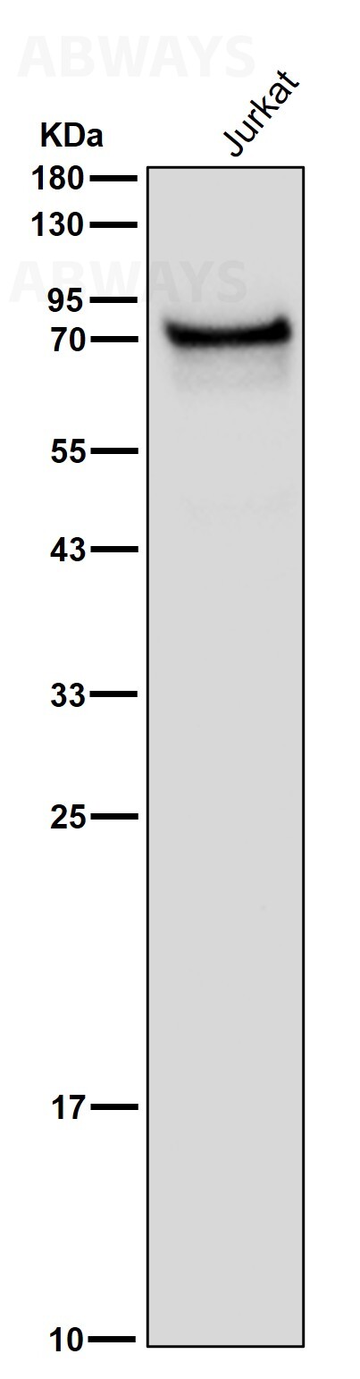 PPM1G Ab