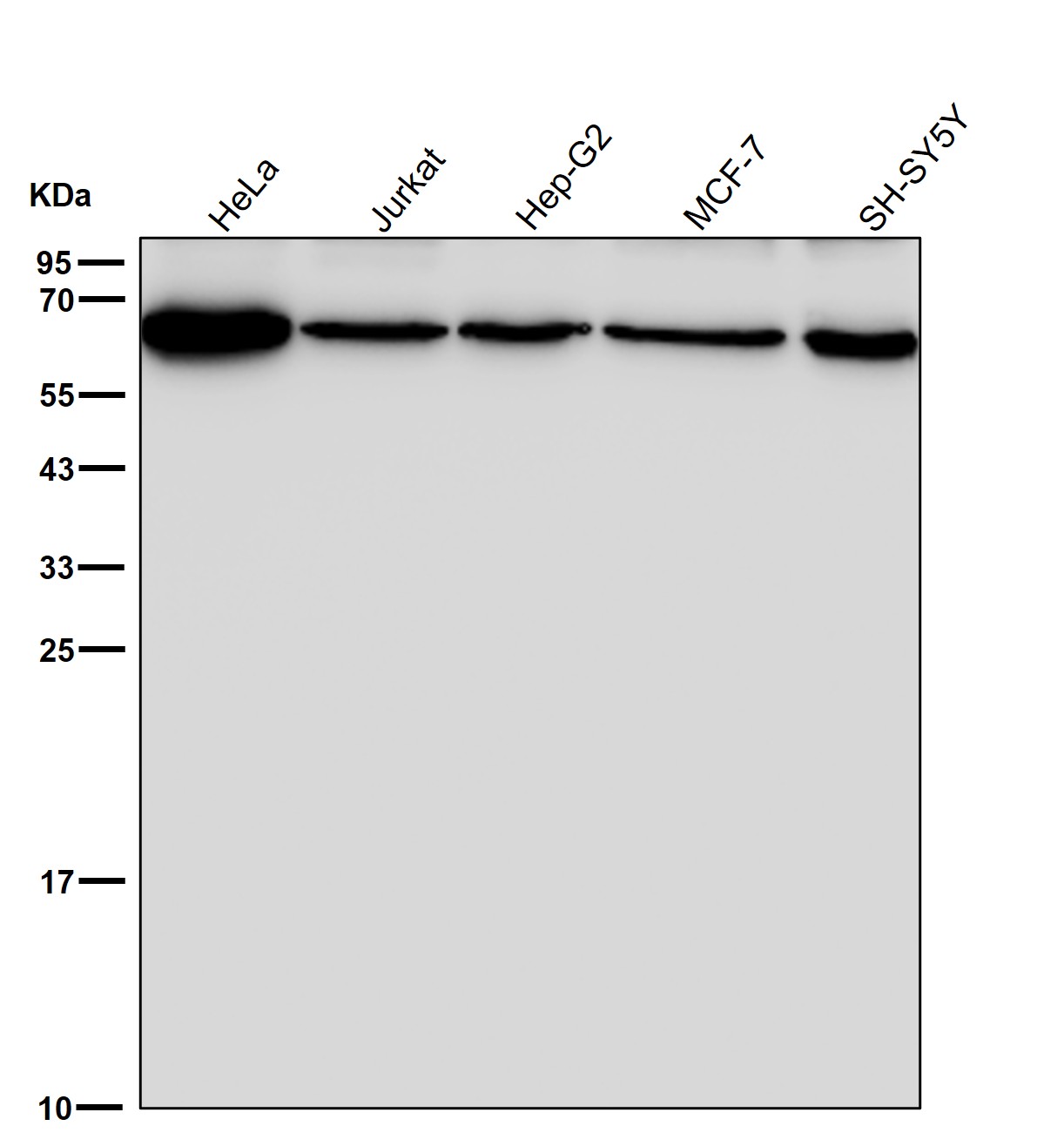 PGM 1 Ab