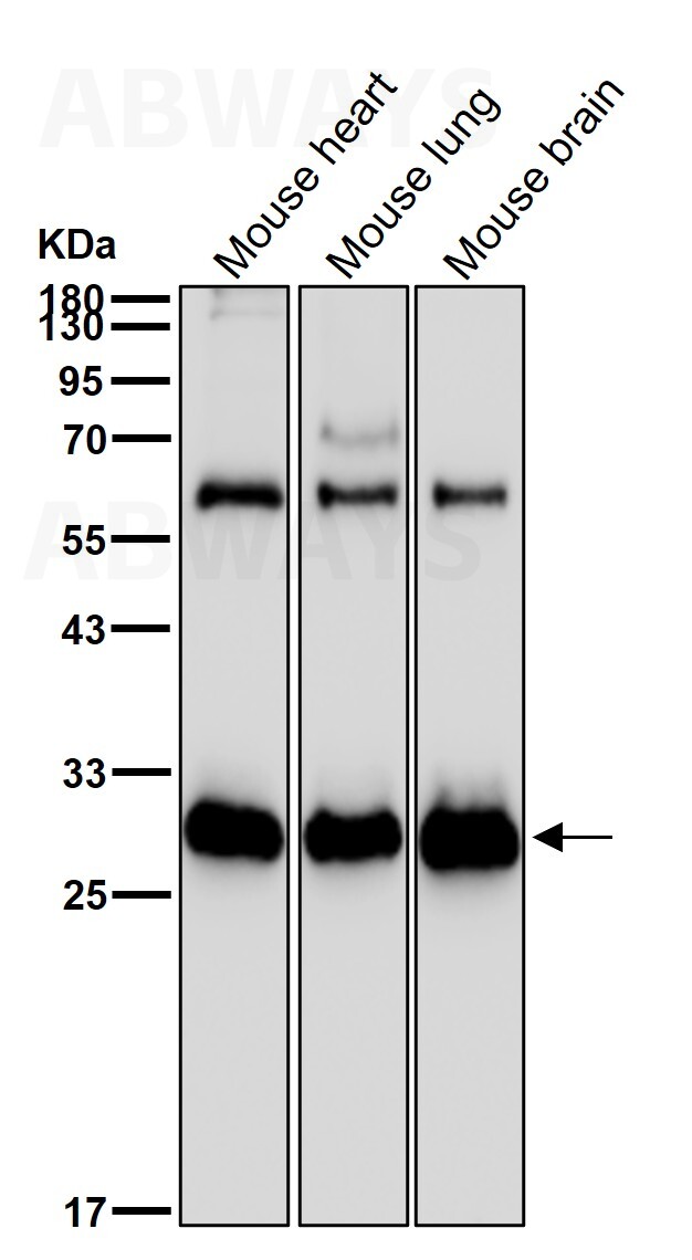 Adiponectin Ab