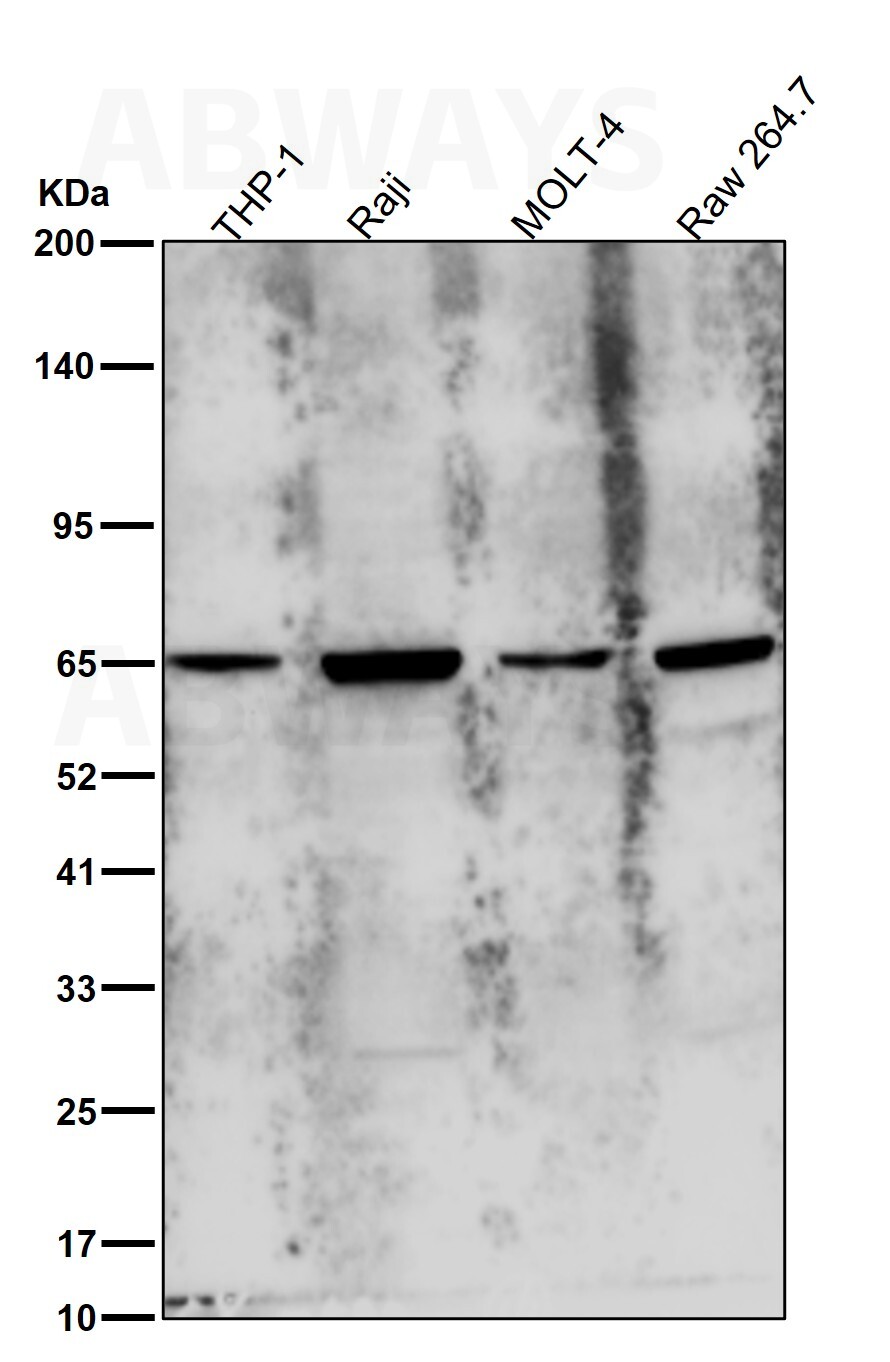 YTHDF2 Ab
