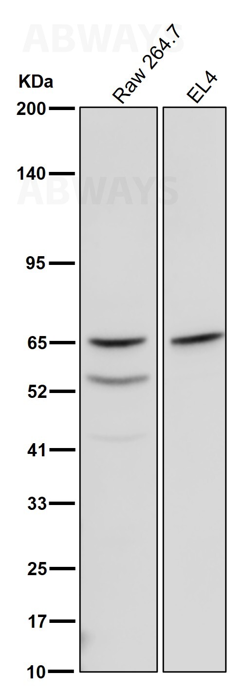 YTHDF2 Ab