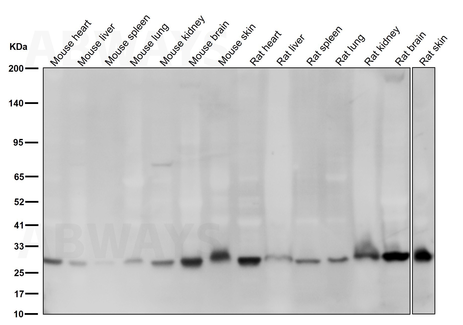 SNAI1 Ab