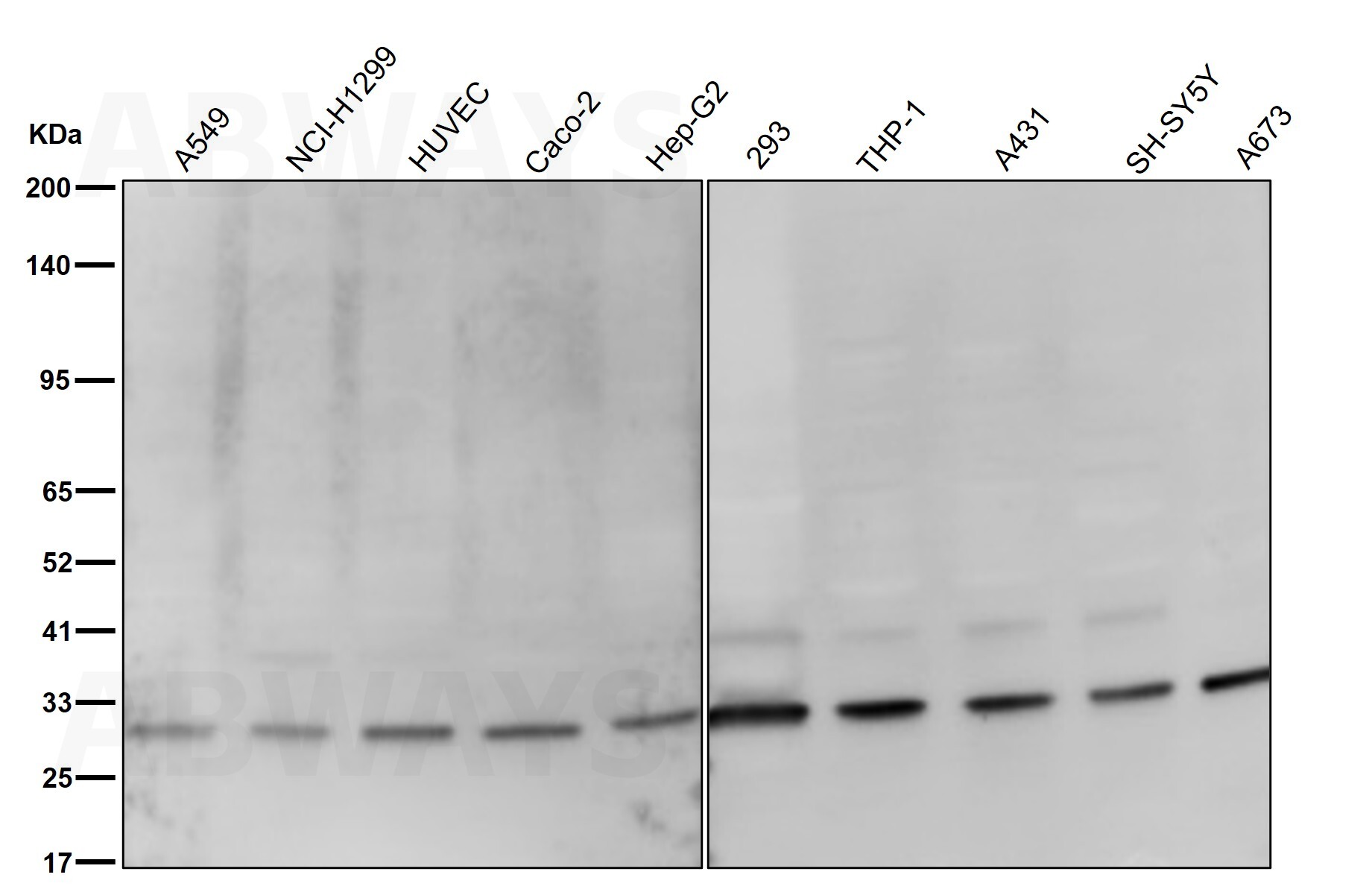 SNAI1 Ab