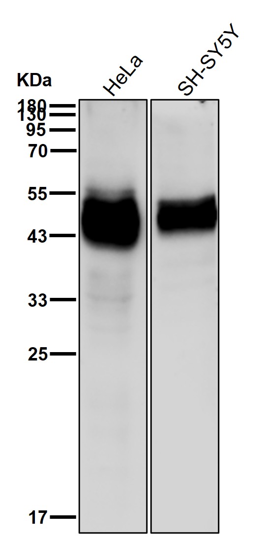 alpha Galactosidase A Ab