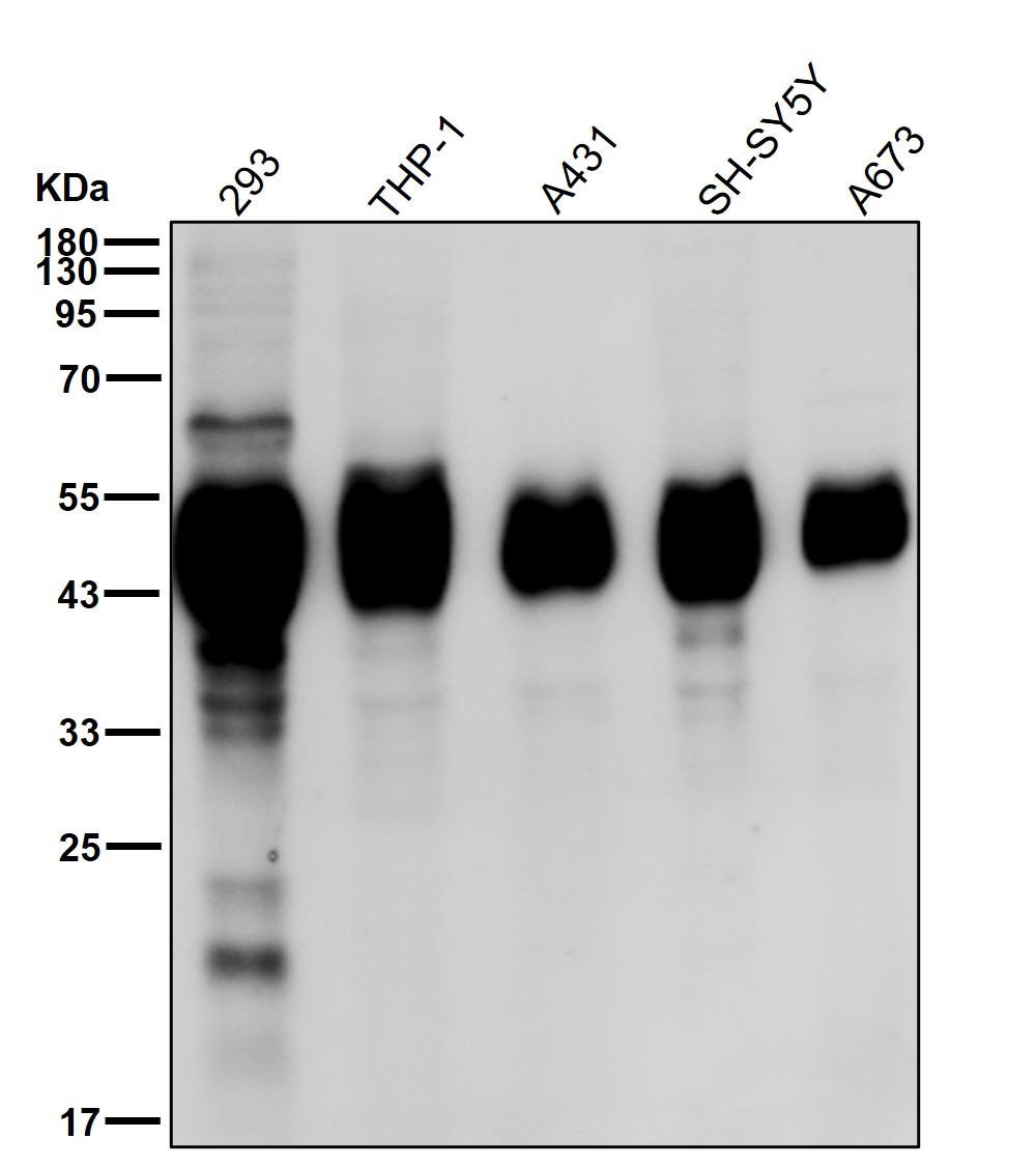 alpha Galactosidase A Ab