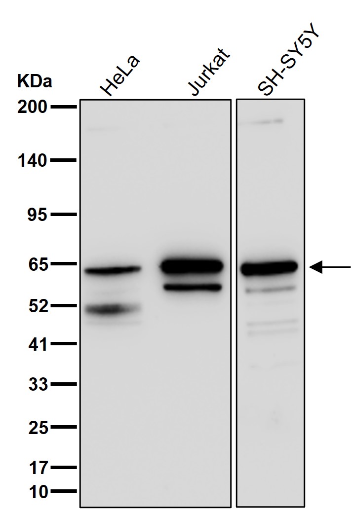 Reticulon 4 receptor Ab