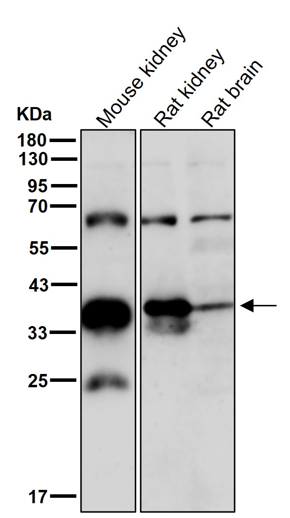 AKR1C1/2 Ab