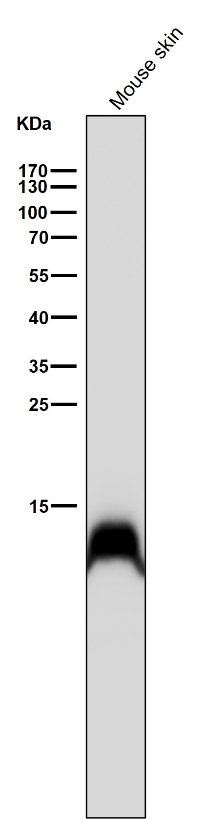 Crotonyl-Histone H2B type 2E (K11) Ab