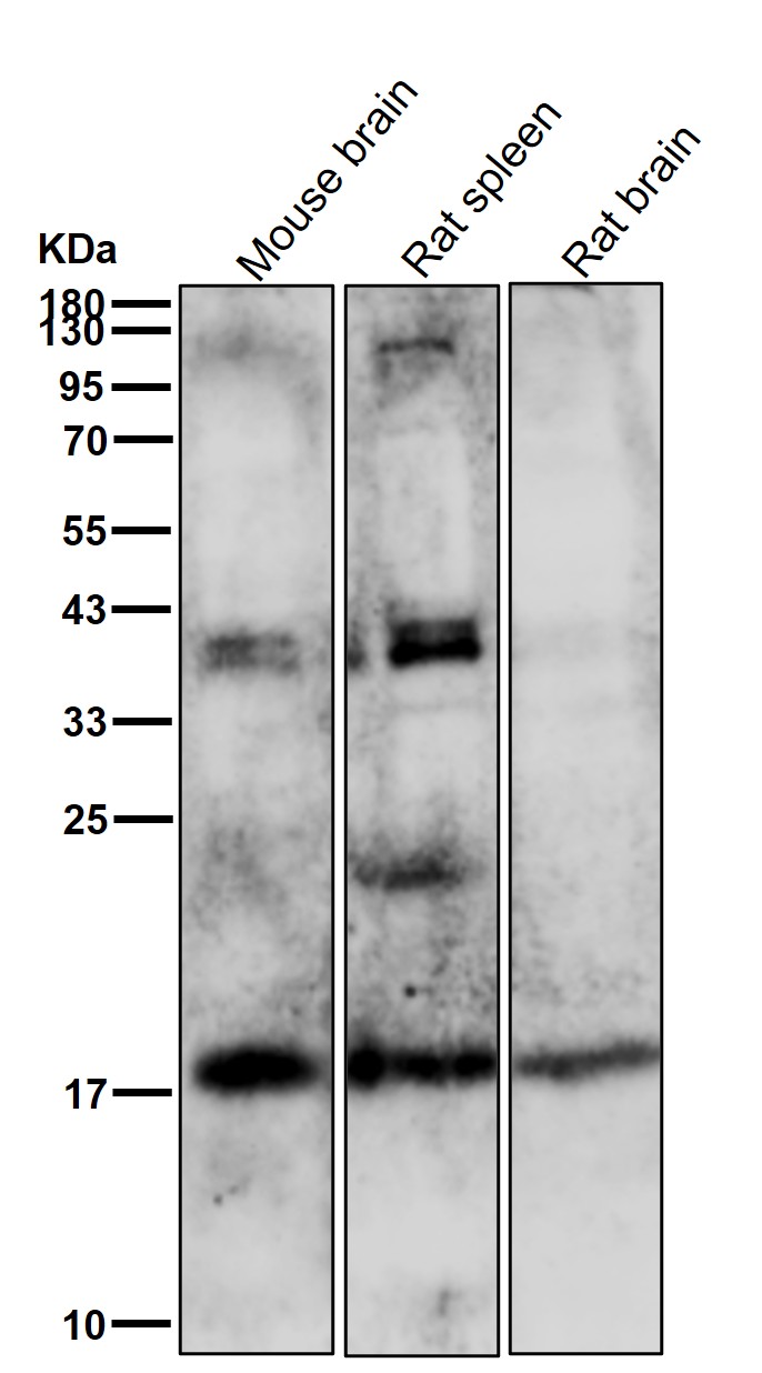 Uteroglobin Ab