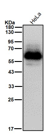 Serotonin transporter Ab