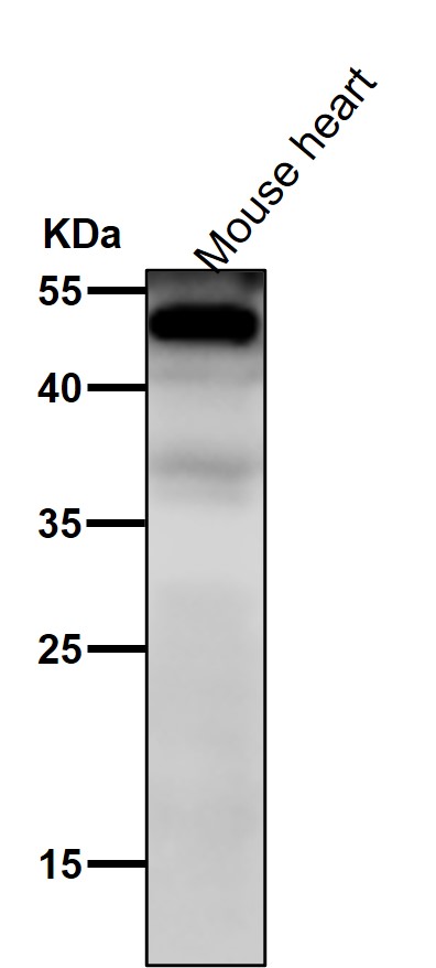 NFIB type Ab