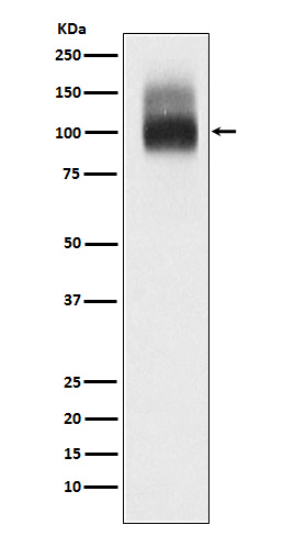 SLC4A1 Ab