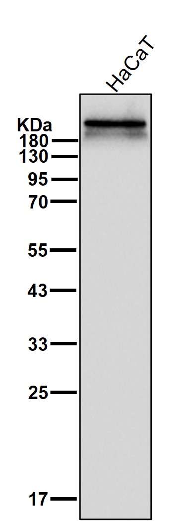 Sortilin related receptor Ab