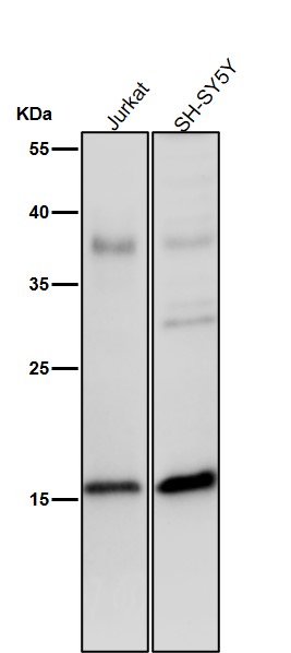 p-Histone H3 (S28) Ab