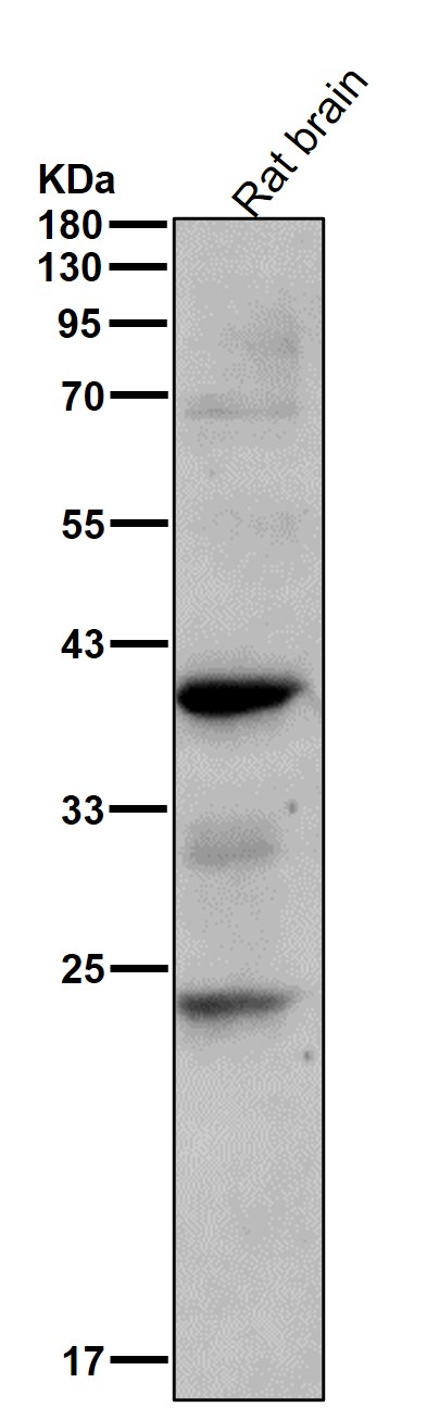 SAE1 Ab