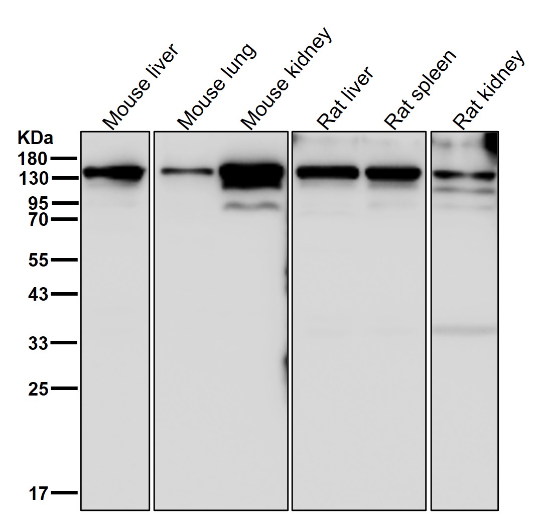 IL 17 receptor A Ab