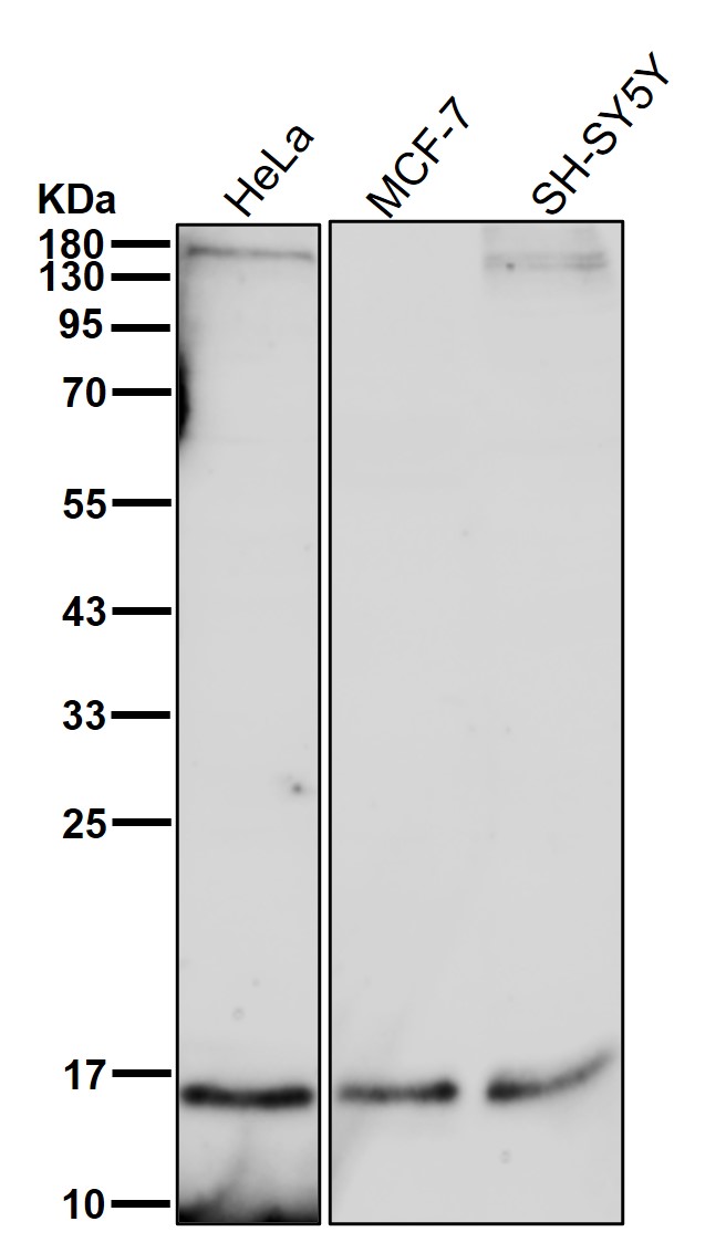 CDKN2C Ab