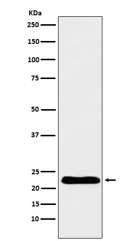 TNNI1 Ab