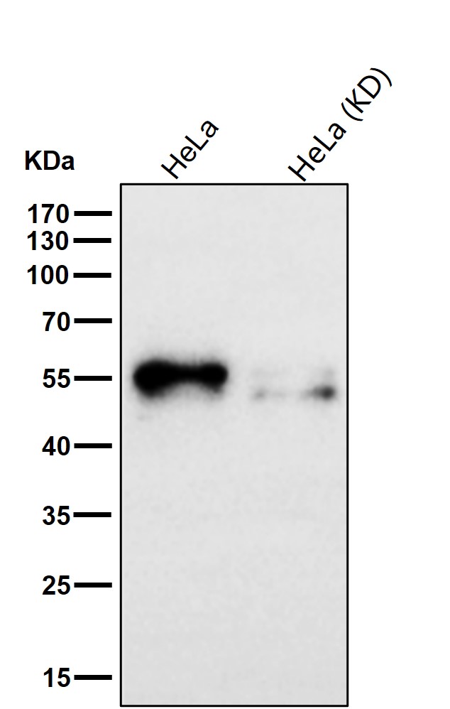Retinoic acid receptor beta Ab