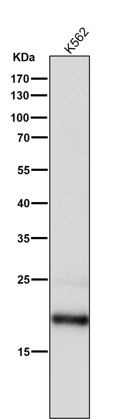 SOCS 2 Ab