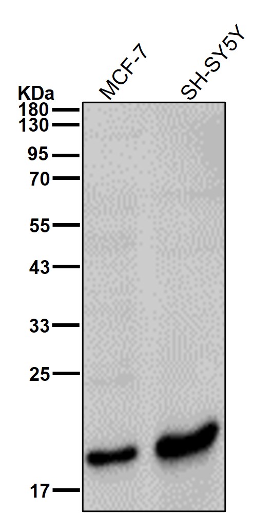 SOCS 2 Ab