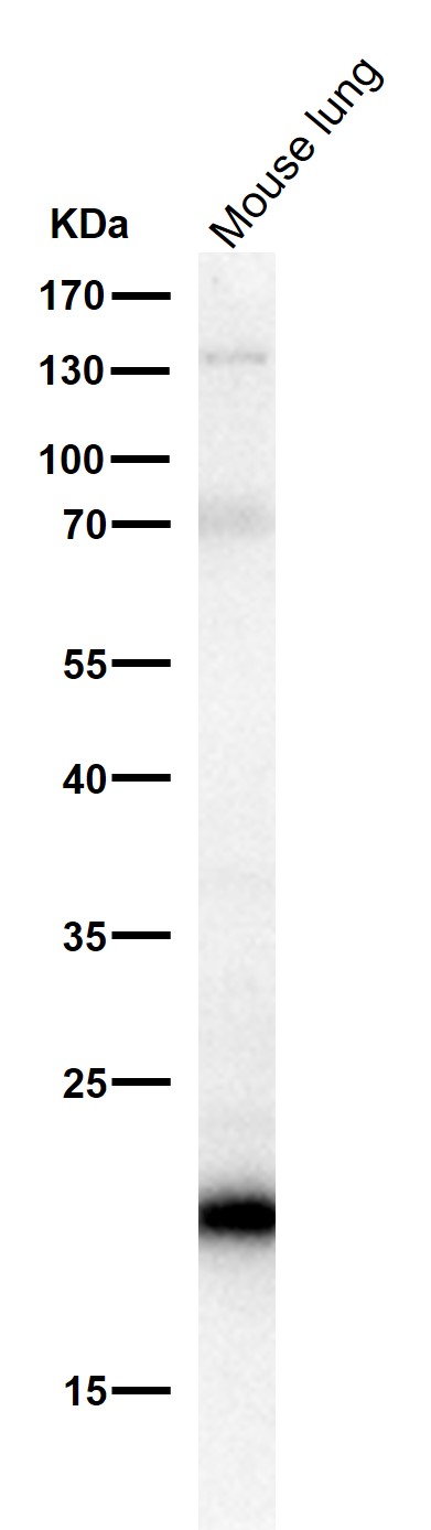 SOCS 2 Ab