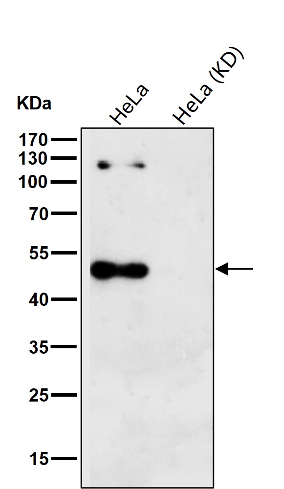AP 2 alpha Ab