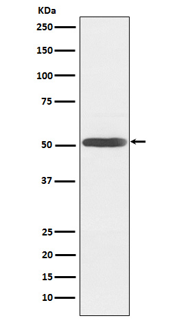 Inhibin beta B chain Ab