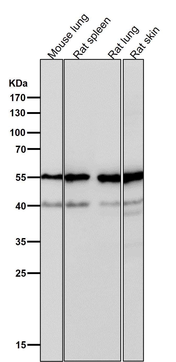 PNPLA2 Ab