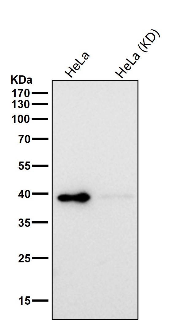 HIF 1 alpha inhibitor Ab