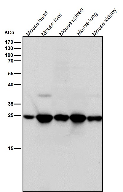BCAP31 Ab