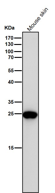BCAP31 Ab