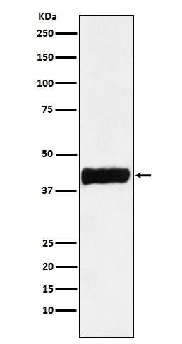 Creatine kinase B type Ab