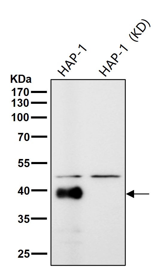 Glycophorin C Ab