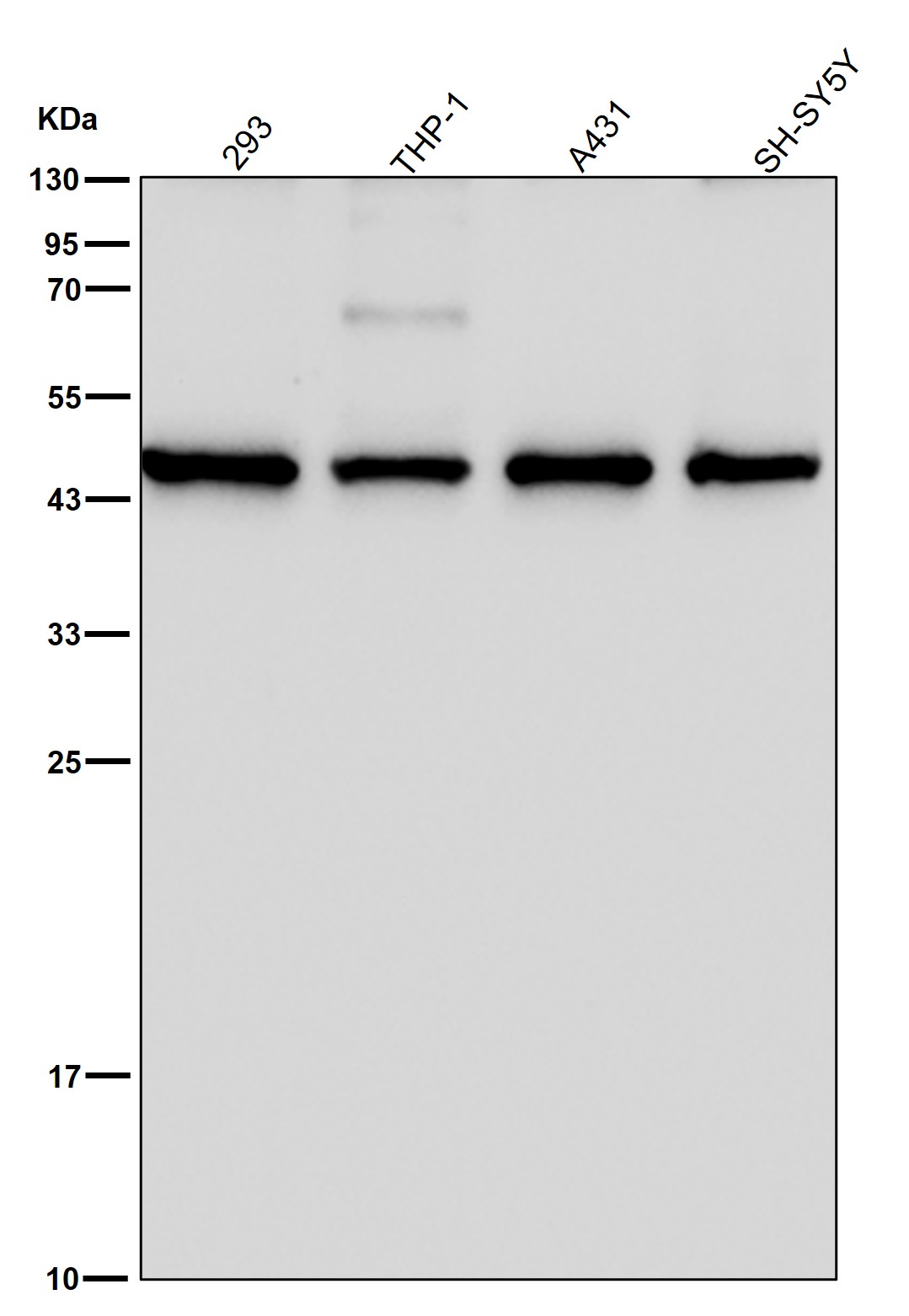 Histamine H3 receptor Ab