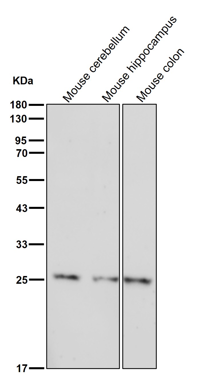 SRD5A2 Ab