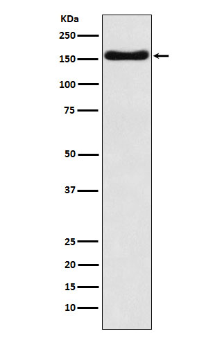 ATP7B Ab