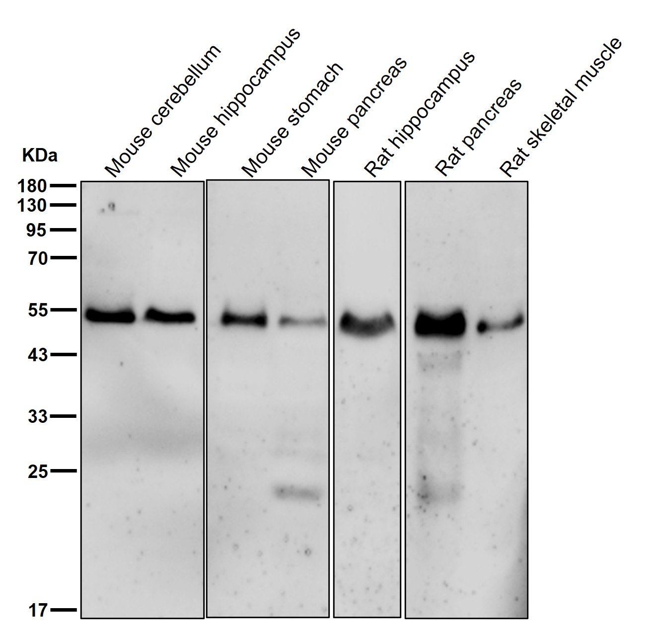 RXRA Ab