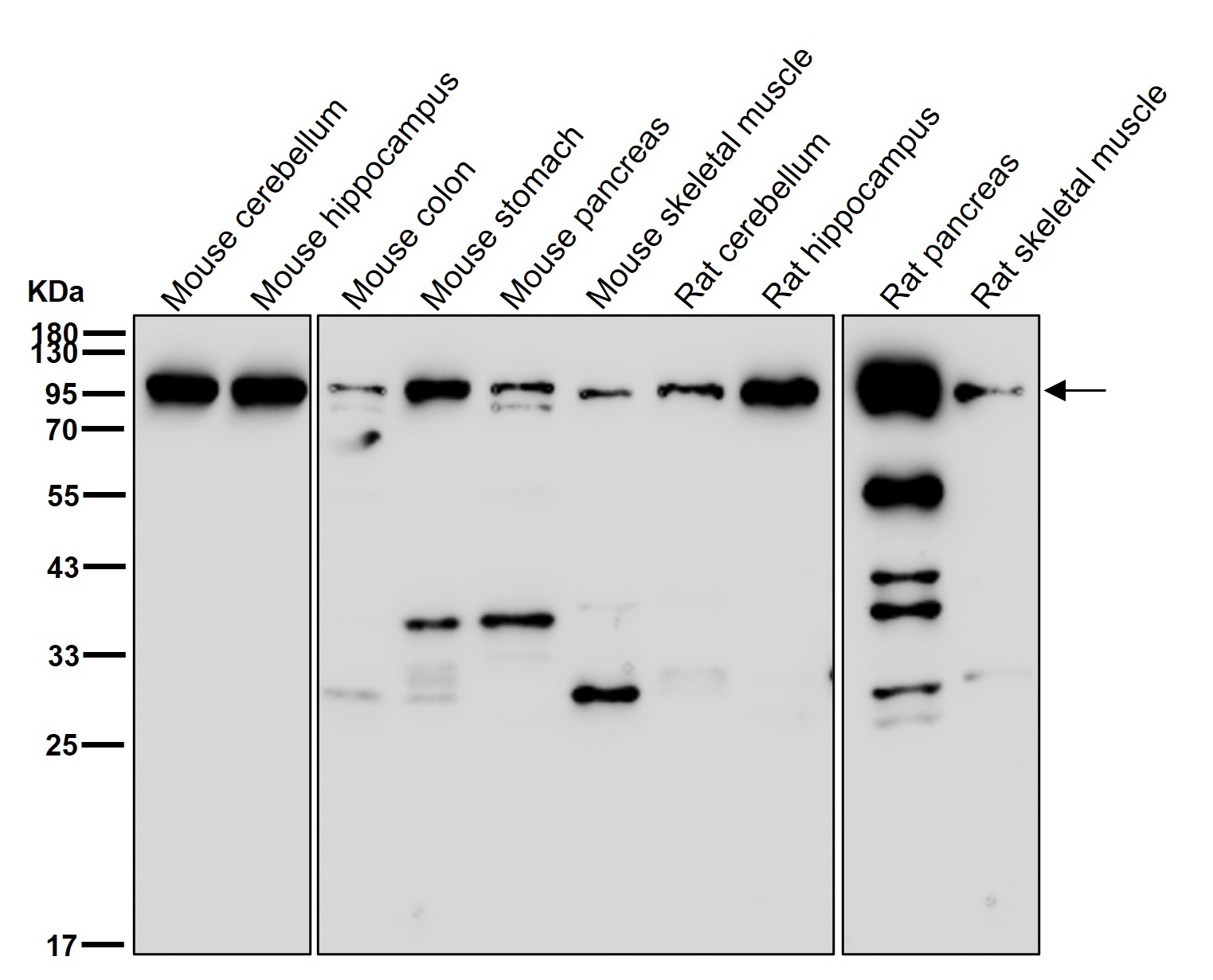 beta Galactosidase Ab