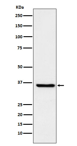 Glutathione S transferase omega 1 Ab