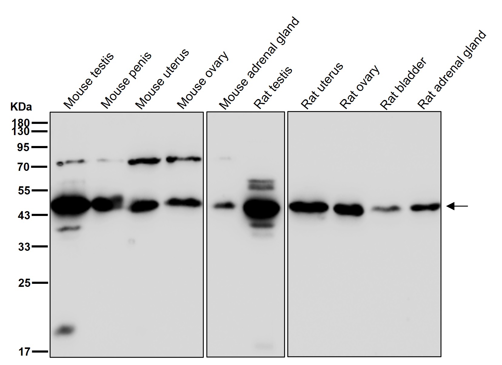 CXCR5 Ab