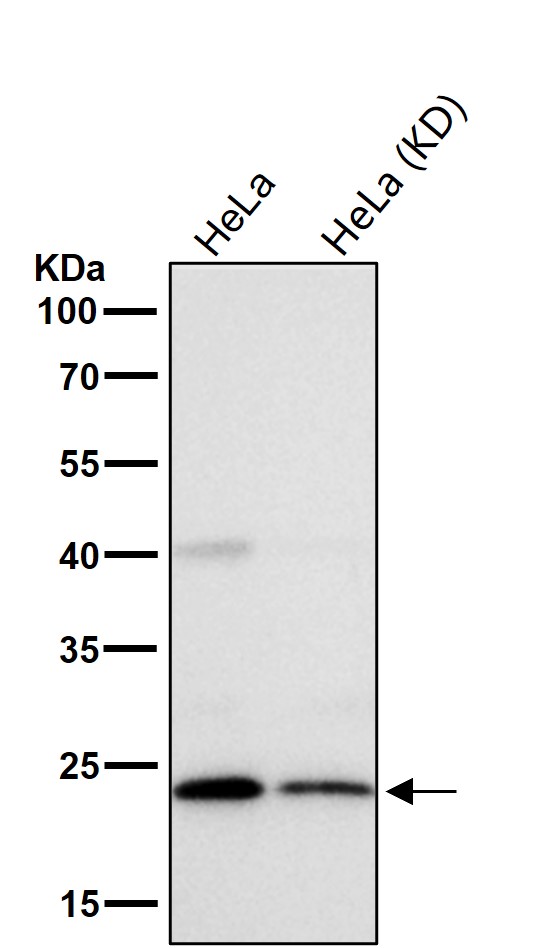 Lactoylglutathione lyase Ab