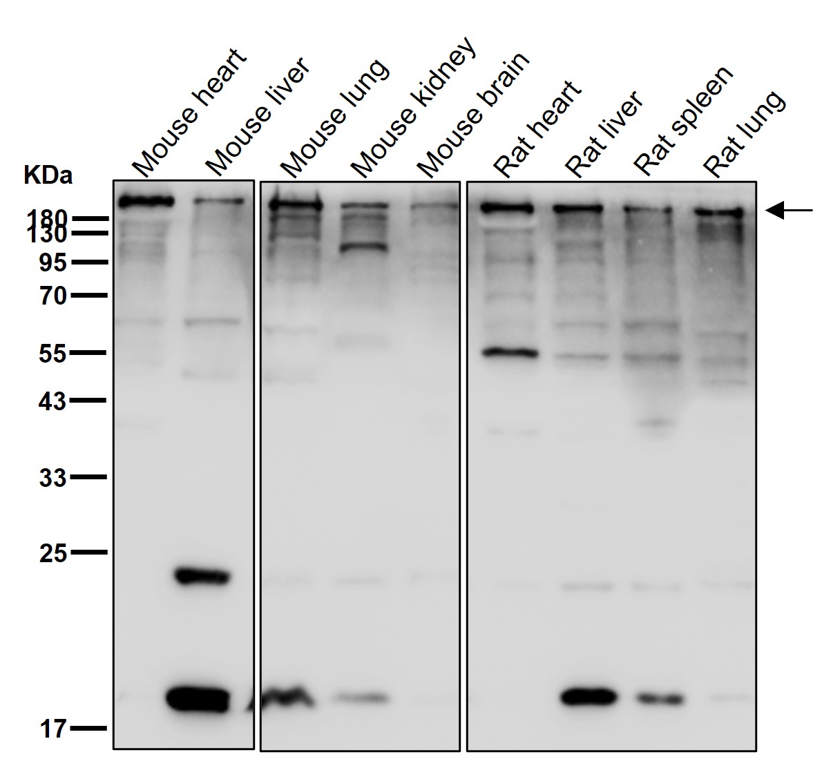 Spectrin alpha chain Ab
