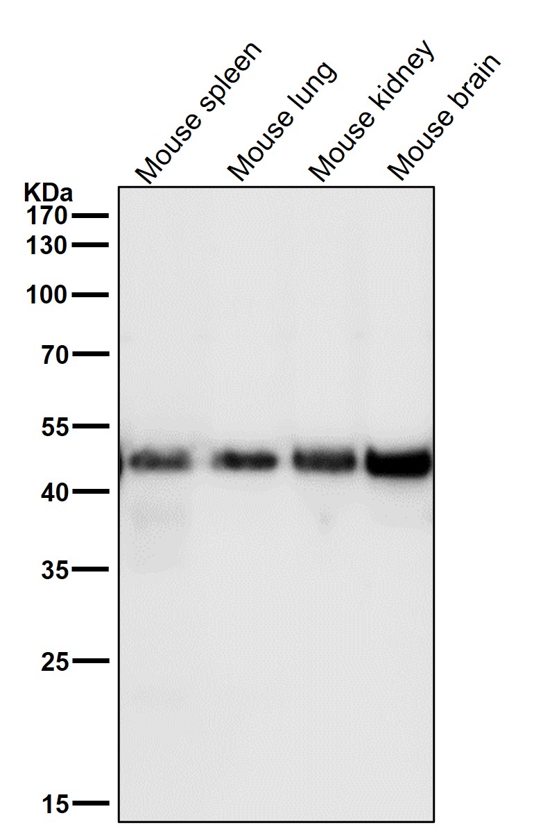 Squalene synthase Ab