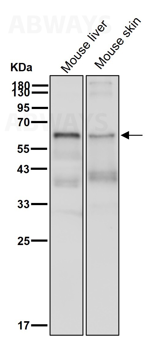 METTL14 Ab