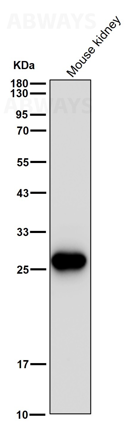 SNAI1 Ab