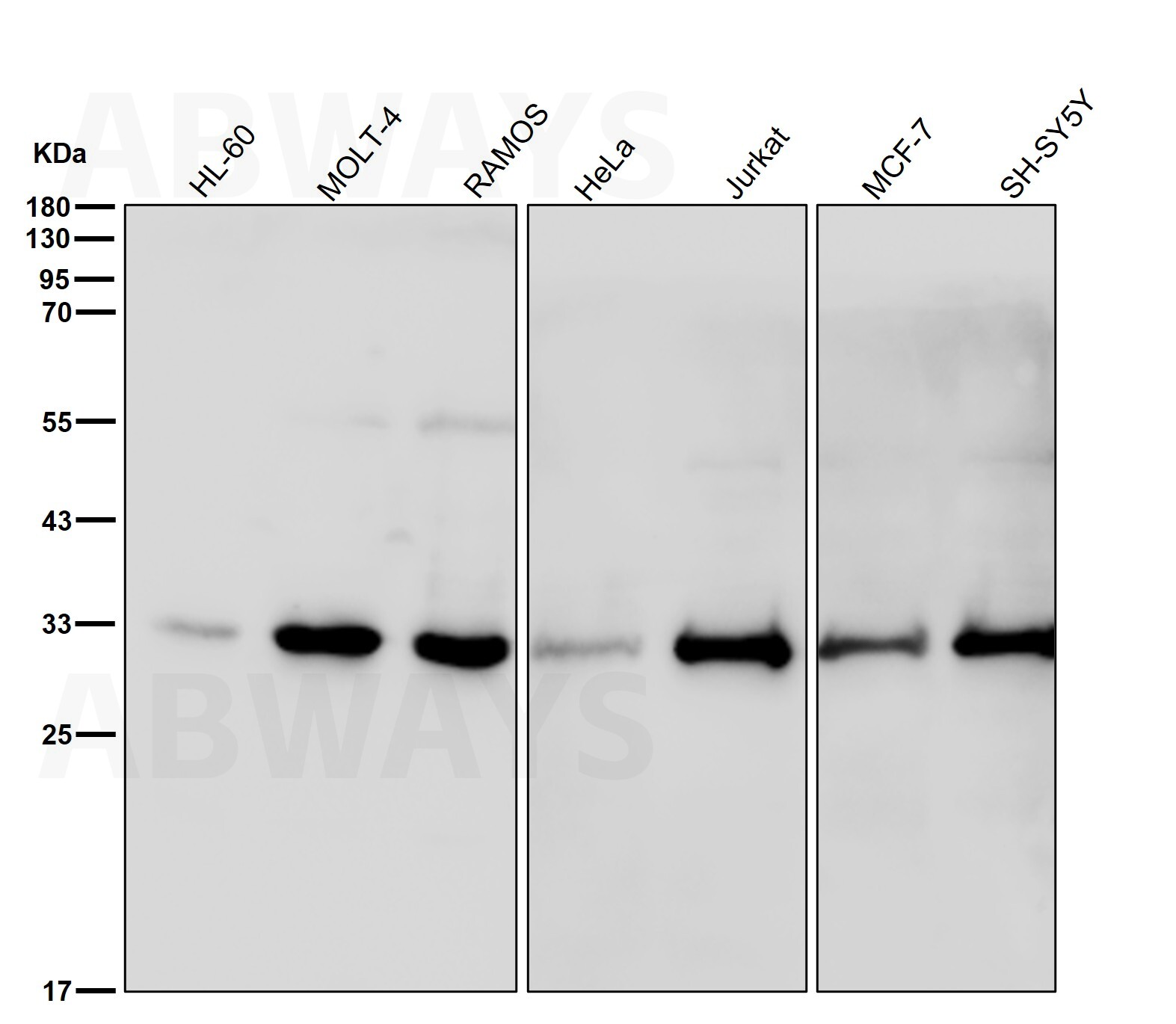 SNAI1 Ab