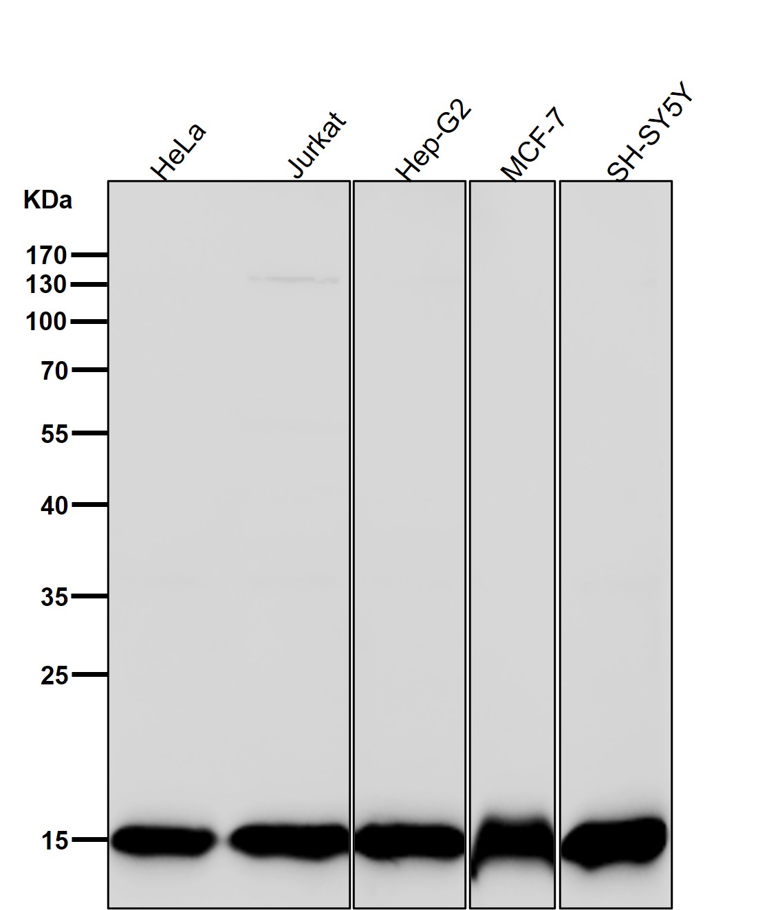 MonoMethyl-Histone H3 (K14) Ab