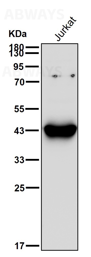 IL 15 receptor alpha Ab